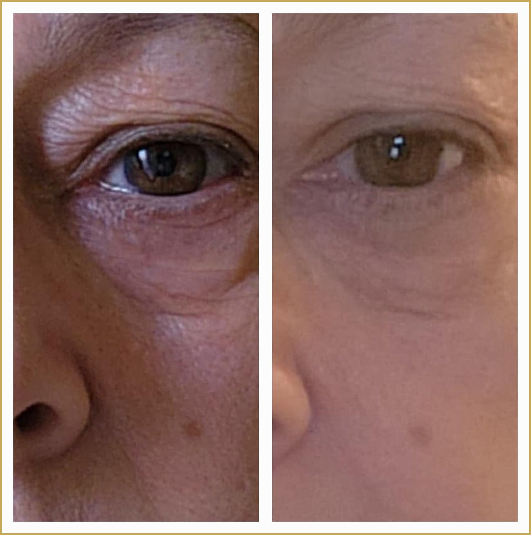 Helen real before and after results