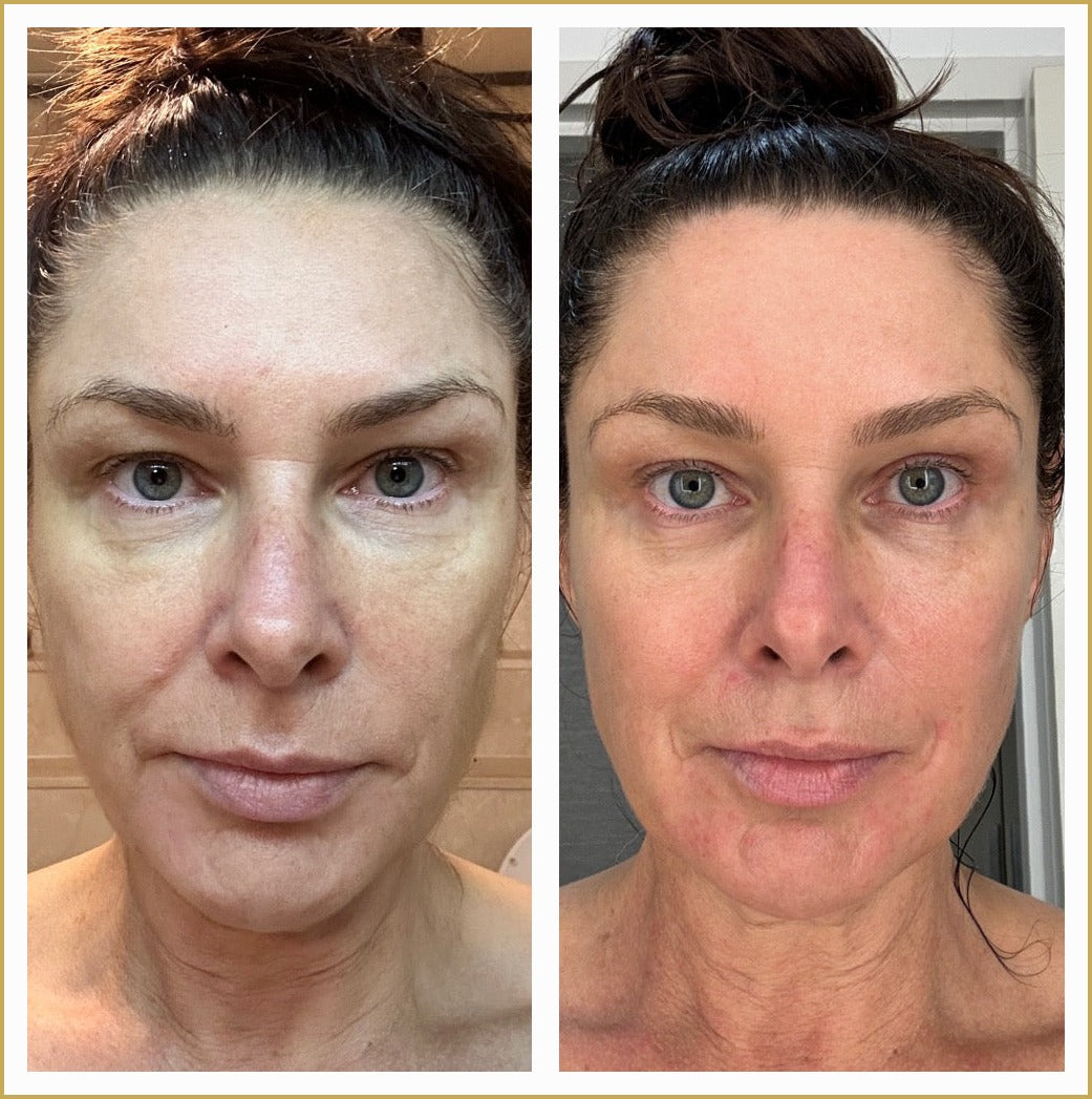 Jacqui real before and after results