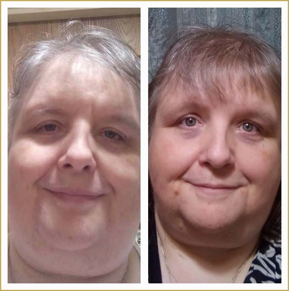 Sarah real before and after results